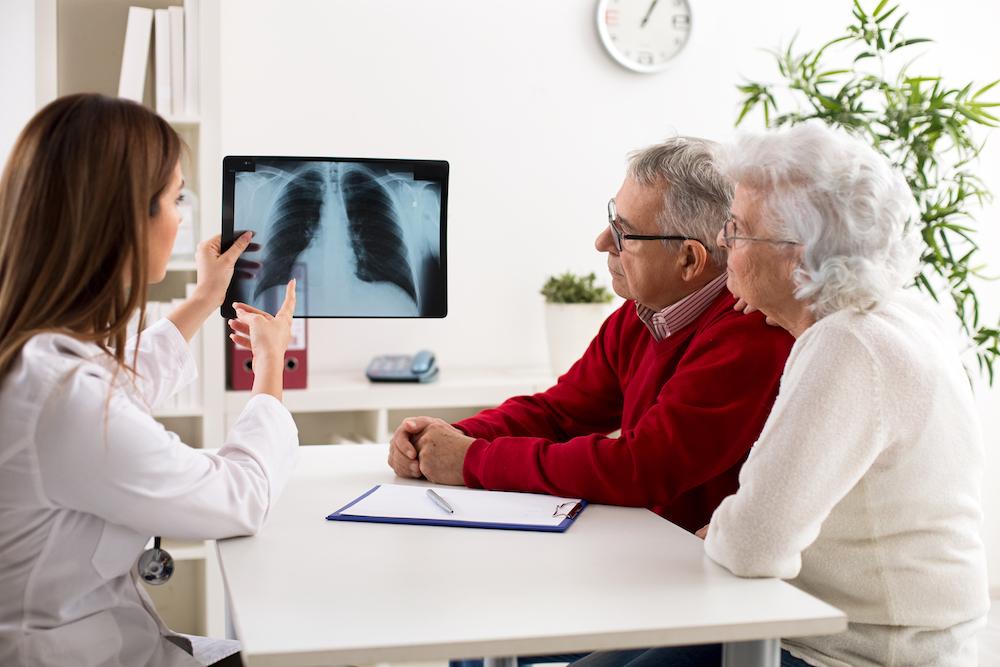 Doctor showing couple xray of chest